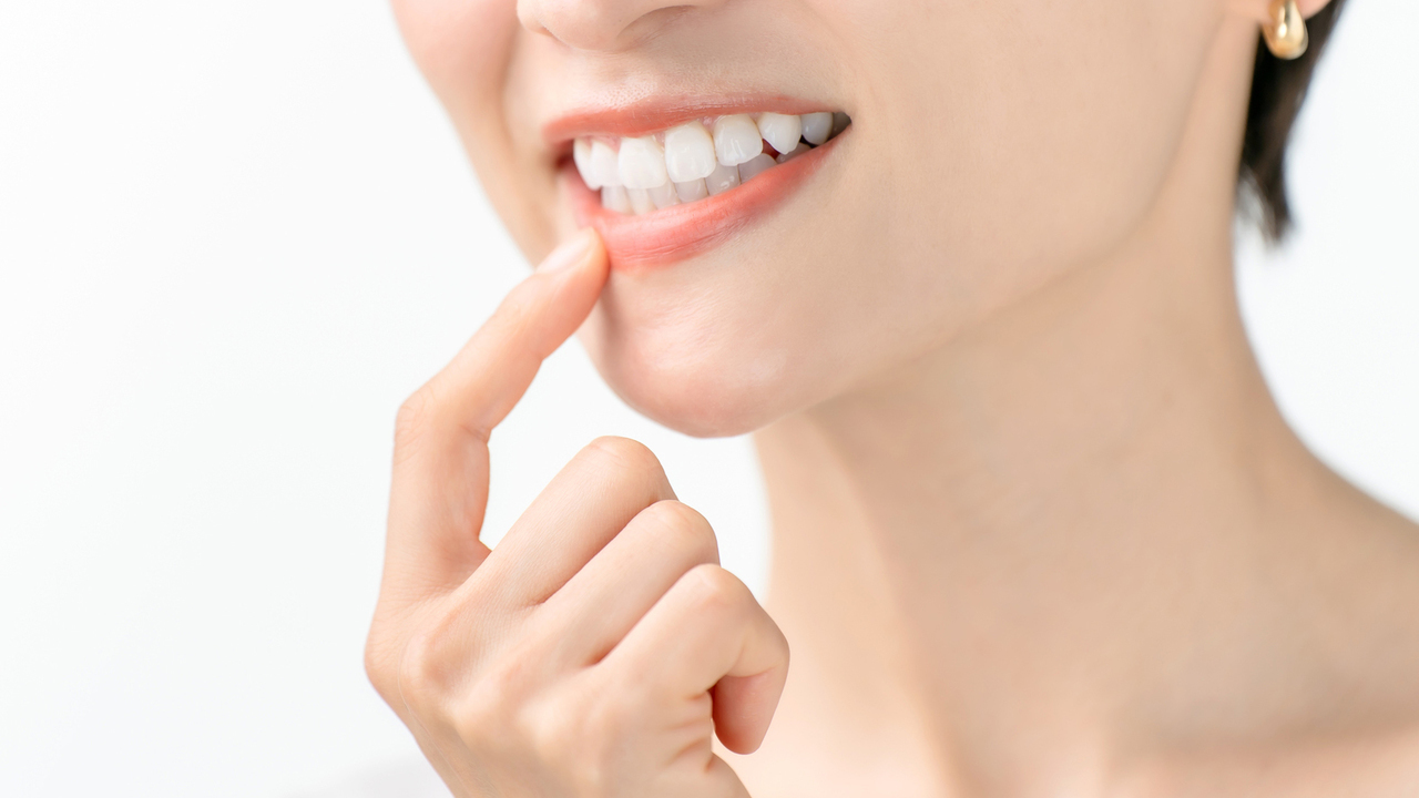 知立市のホームホワイトニング