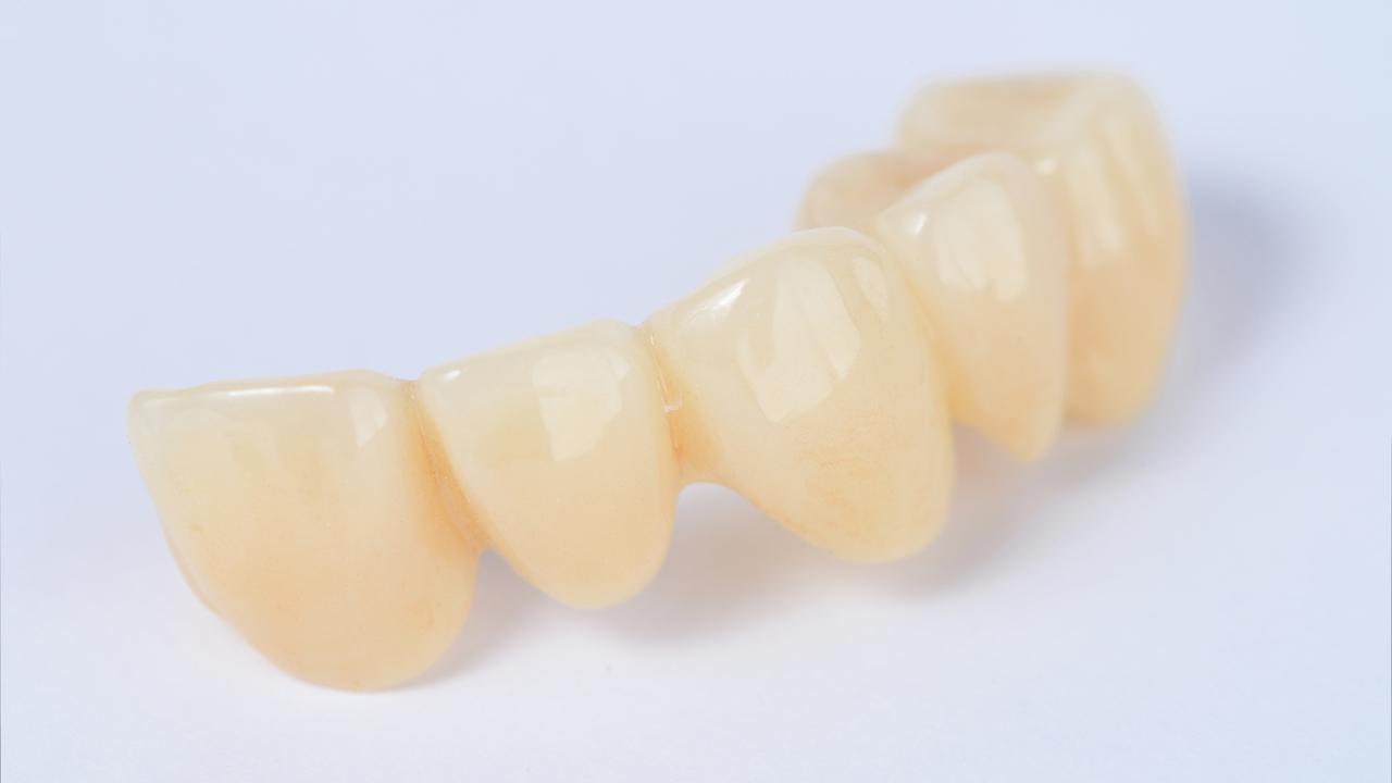 知立市のジルコニア治療