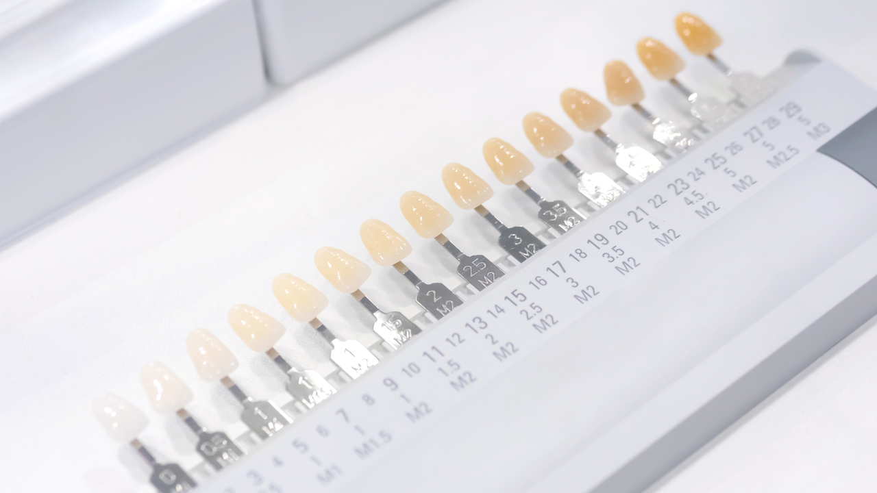 知立市のブライダルホワイトニング