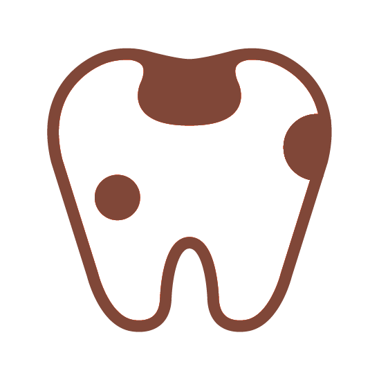 知立市の虫歯の治療