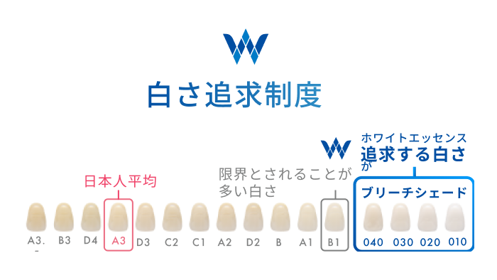 知立市のデュアルホワイトニング