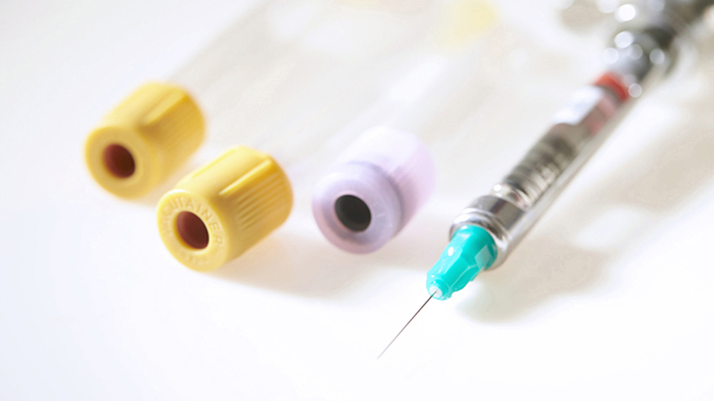 知立市の虫歯の治療