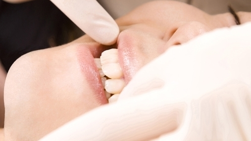 知立市の虫歯の治療