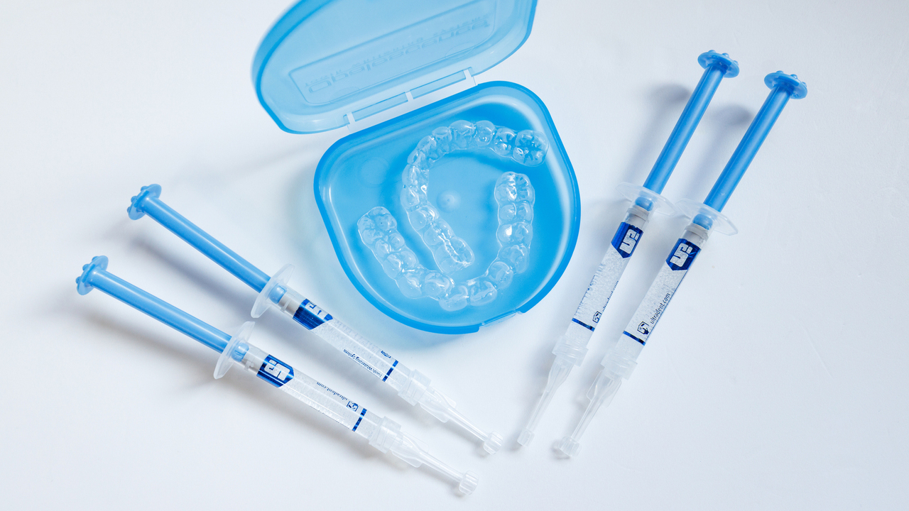 知立市のデュアルホワイトニング