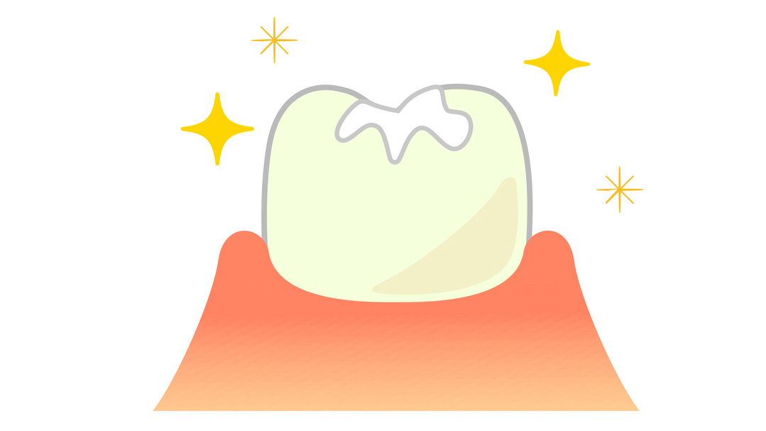 知立市の小児歯科