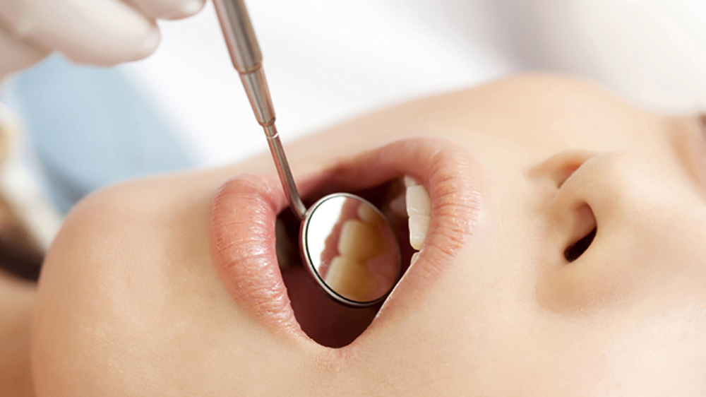 知立市の知覚過敏の治療