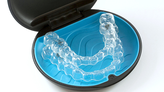 知立市の子供のマウスピース矯正（インビザラインファースト）