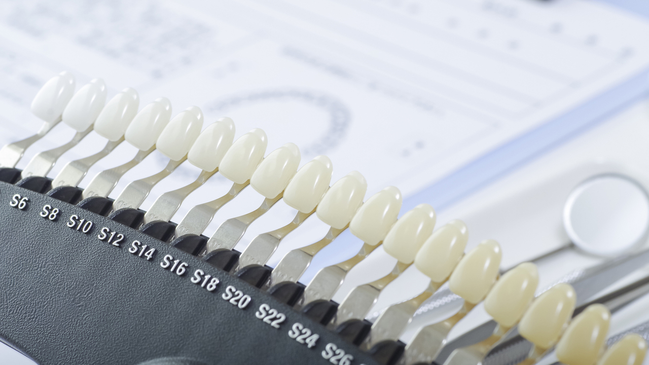 知立市のブライダルホワイトニング