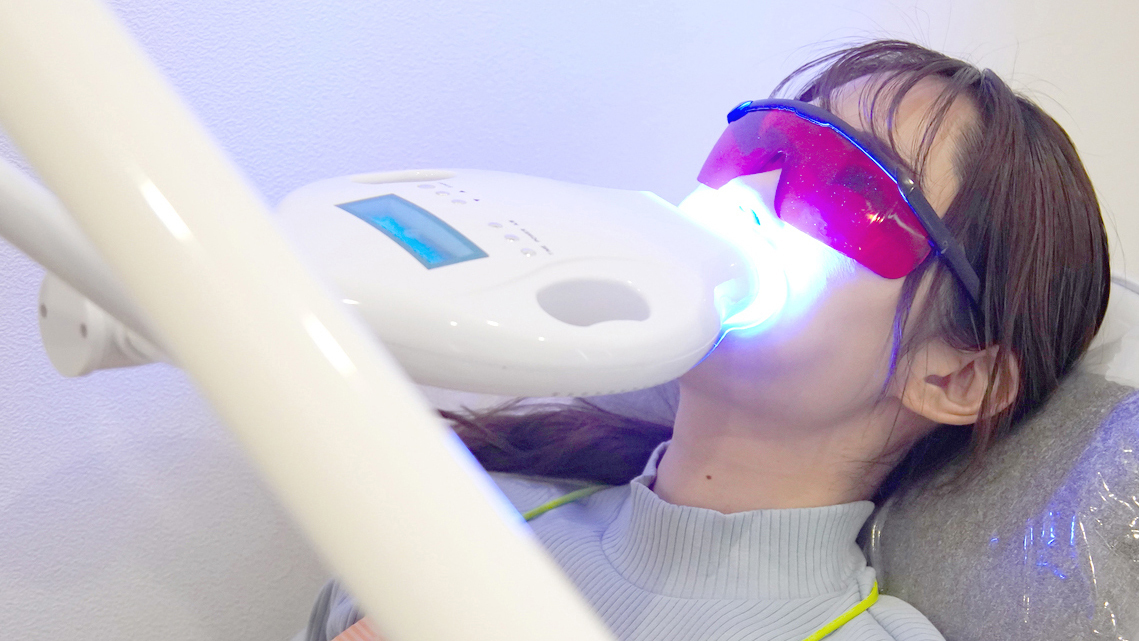 知立市のブライダルホワイトニング