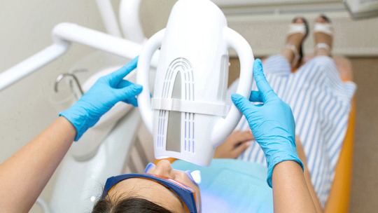 知立市のデュアルホワイトニング