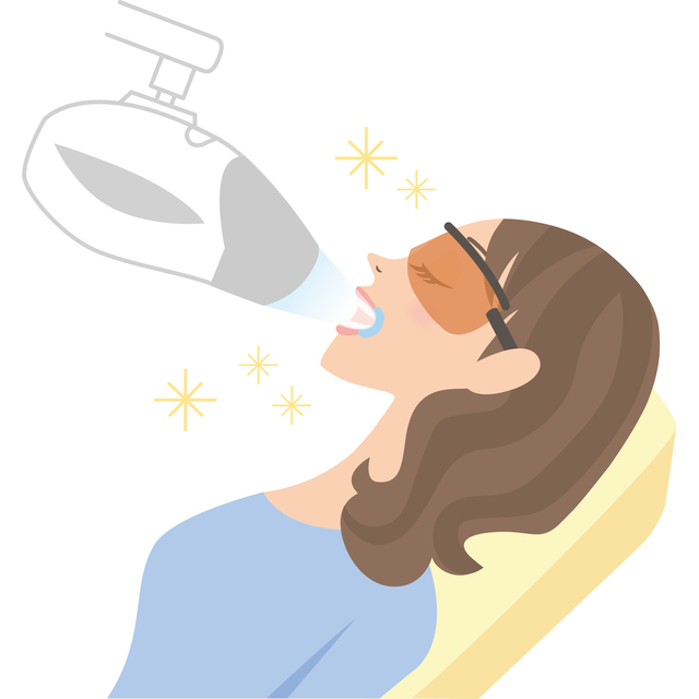 知立市のデュアルホワイトニング