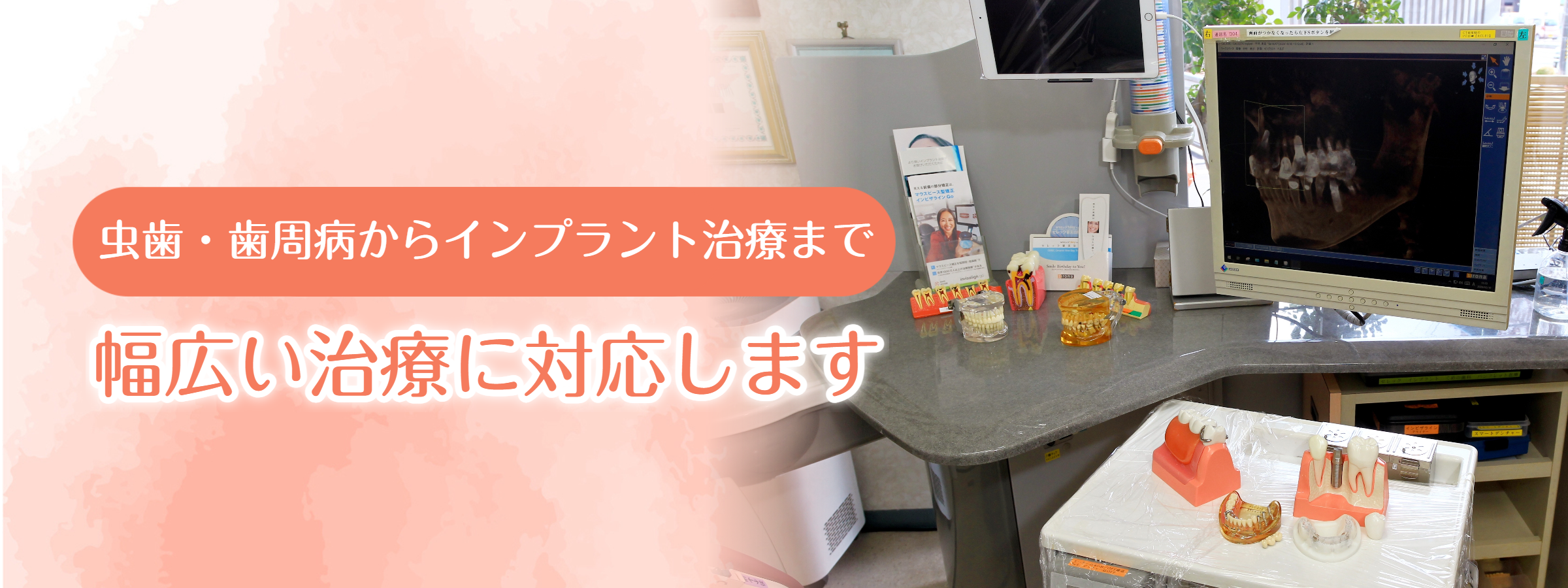 知立市のおすすめ歯医者・歯科｜歯科医院なら｜くめの歯科