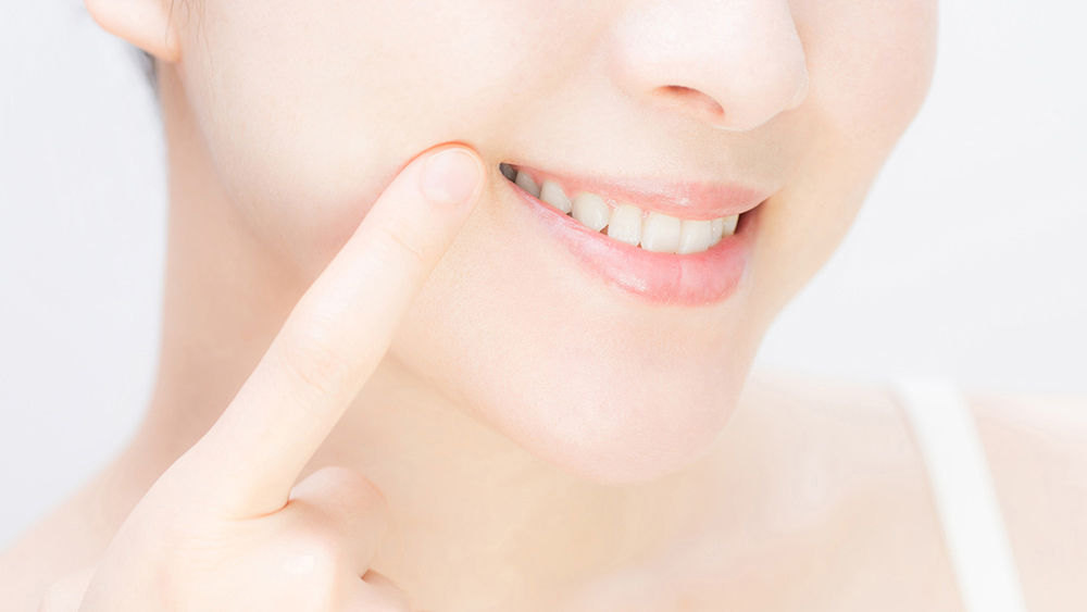 知立市のデュアルホワイトニング