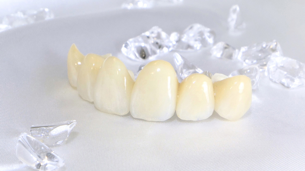 知立市のセレック1dayトリートメント