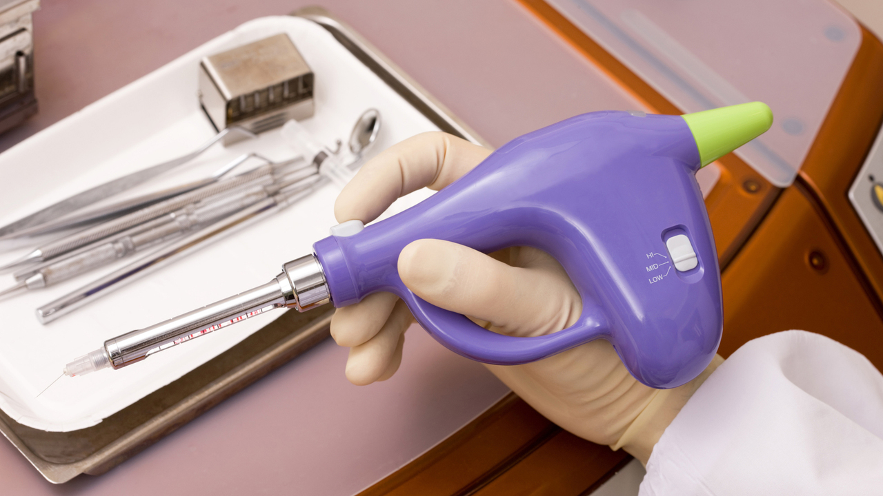 知立市の虫歯の治療