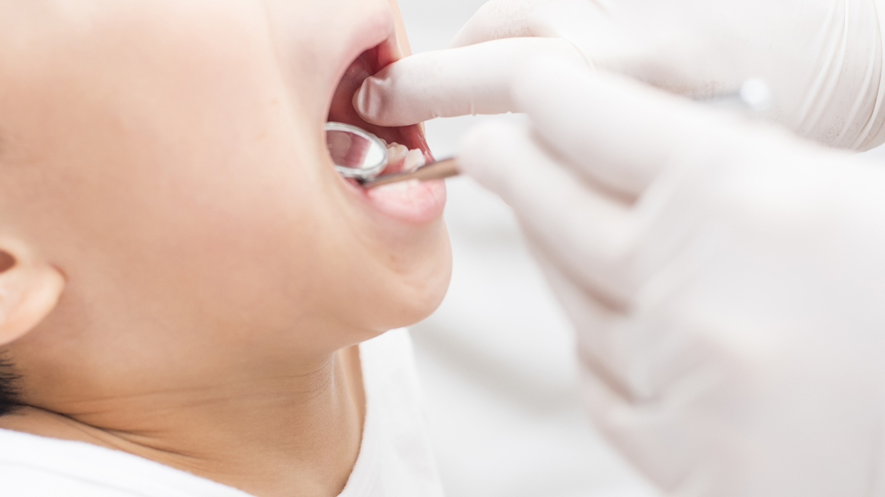 知立市の小児歯科